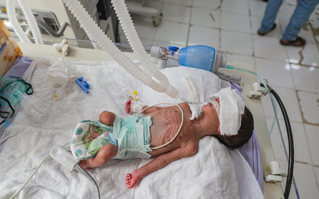 Baby Mohammed fights for life - Melanie Swan/Red Crescent