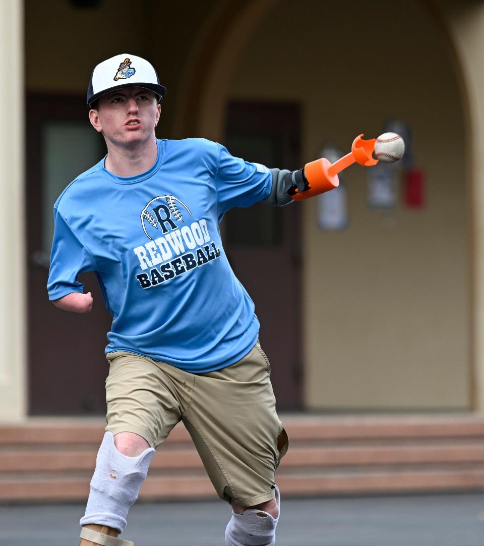 Tyler Stark tries out a prosthetic hand Tuesday, May 2, 2023 designed by a group of engineering students at Redwood High School. He will throw out the first pitch Tuesday, May 9 against Mt. Whitney.