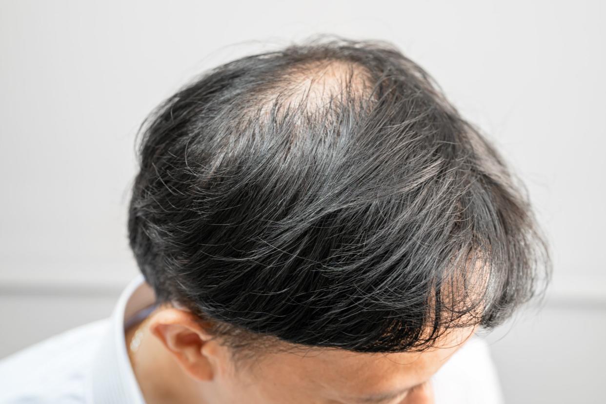 Bald in the middle head and begin no loss hair glabrous of mature Asian business smart active office man.