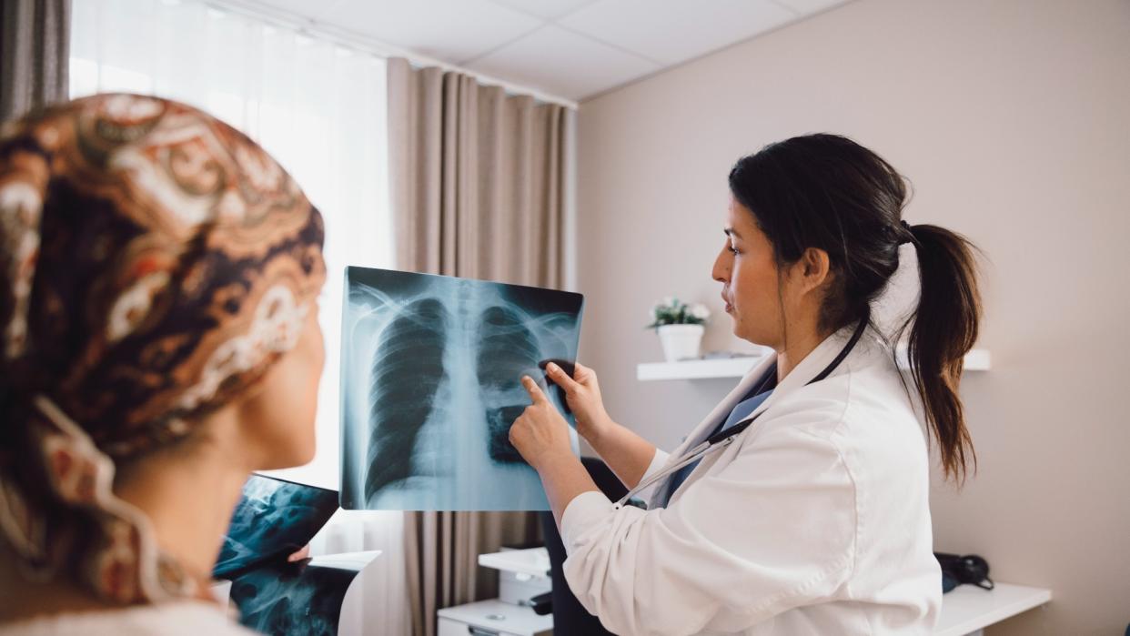  Female doctor talking to female cancer patient while examining x-ray in doctor's office. 