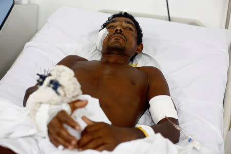 Jose Ribamar from Brazil's indigenous Gamela tribe is pictured at a hospital after he was injured in a dispute over land in northern Brazil, in Sao Luis, Maranhao state, Brazil, May 2, 2017. REUTERS/Lunae Parracho