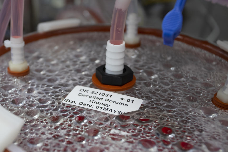 CORRECTS COMPANY NAME TO MIROMATRIX NOT MICROMATRIX - A label on a bioreactor indicates it contains a pig kidney in a Miromatrix laboratory on Tuesday, Dec. 8, 2022, in Eden Prairie, Minn. (AP Photo/Andy Clayton-King)