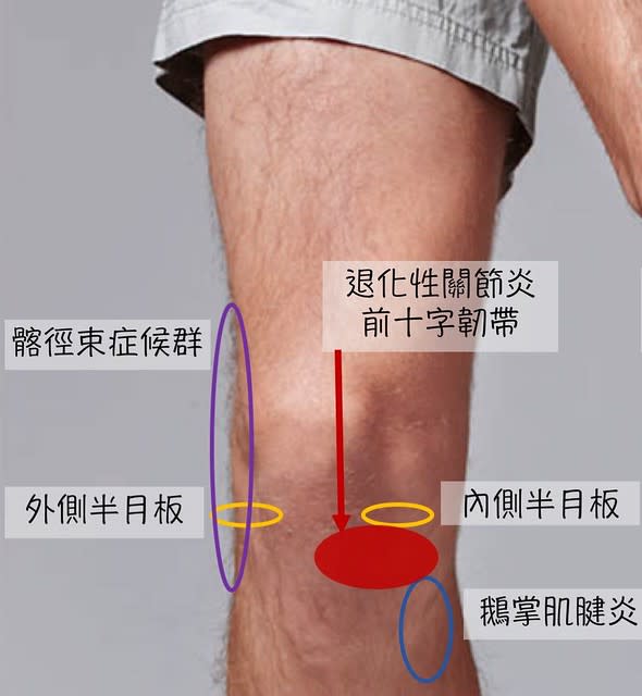 膝蓋痛的原因2