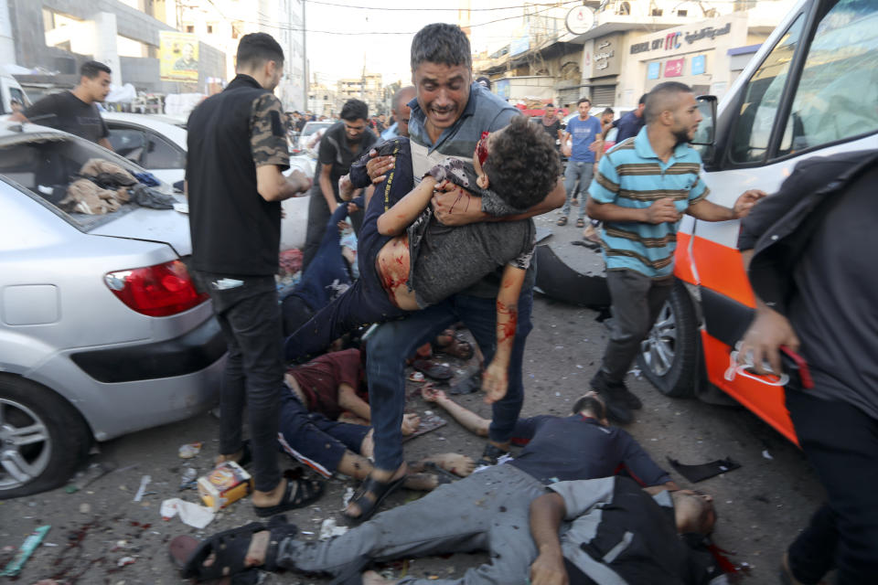 Dead and injured Palestinians are seen on the ground following an Israeli airstrike outside the entrance of the al-Shifa hospital in Gaza City, Friday, Nov. 3, 2023. (AP Photo/Abed Khaled)