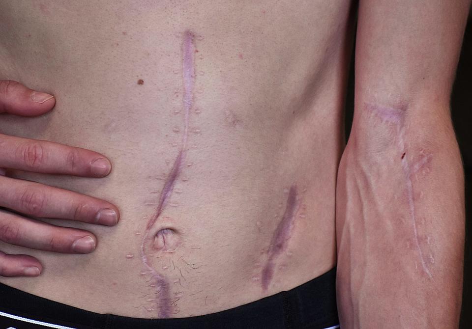 Corey Andrade shows his scars in 2022, after a vicious stabbing left him near death.