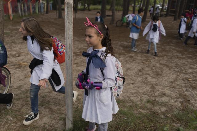 Mia Rodriguez waits her class' turn to enter school in Salinas, Uruguay, Friday, April 14, 2023. Before getting her prosthetic hands, Mia, whose fingers did not fully develop, did not want to eat next to her classmates and begged to be allowed to eat alone in the kitchen. (AP Photo/Matilde Campodonico)