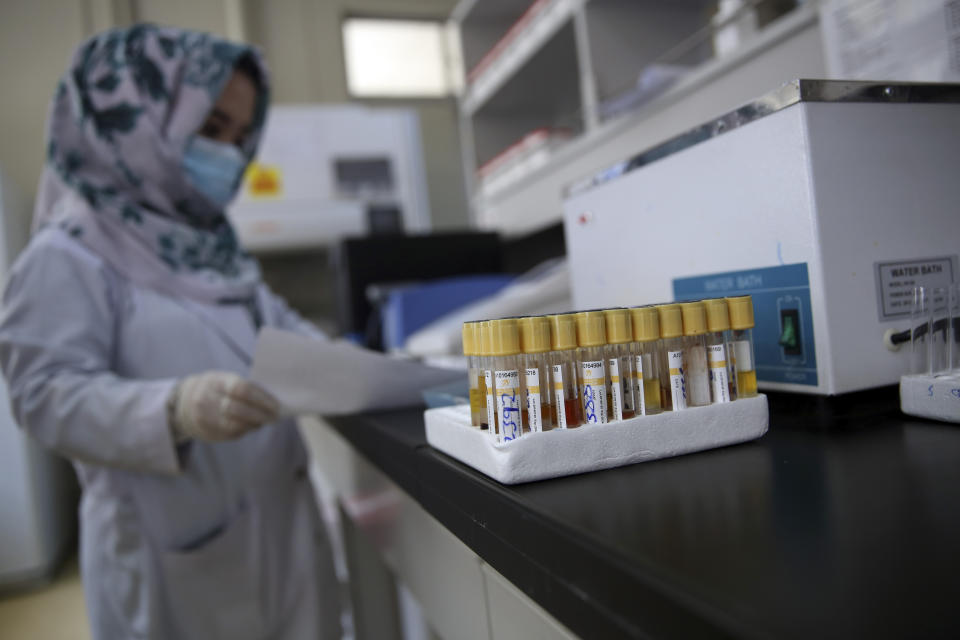 An Afghan lab technician tests samples at the Afghan-Japan Communicable Disease Hospital, treating COVID-19 patients in Kabul, Afghanistan, Tuesday June 30, 2020. (AP Photo/Rahmat Gul)