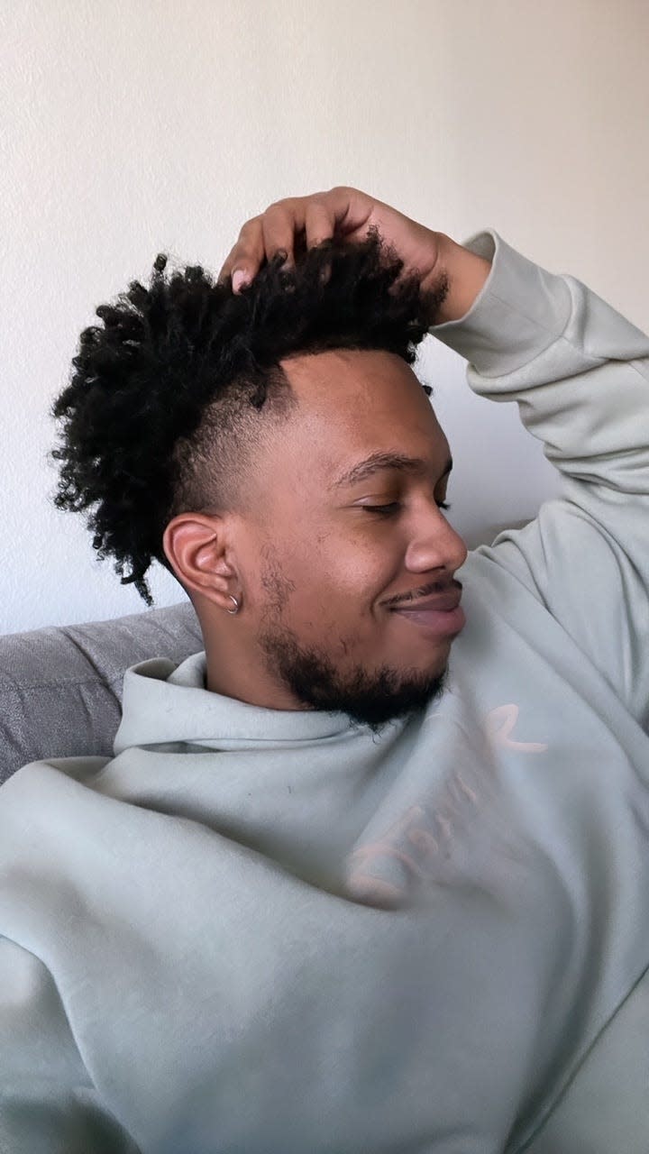 Christian Daniels, 27, said all his hair grew back after participating in the Olumiant clinical trials at Yale School of Medicine.