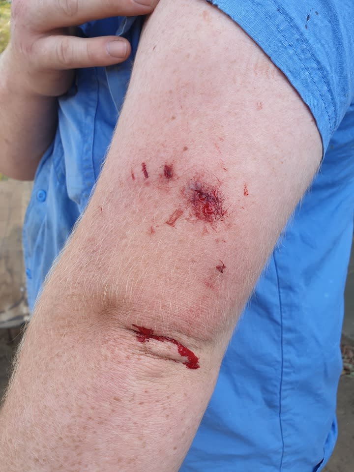 A photo of a Queensland snake catcher's arm after he was bitten by a dog while out on a call-out.