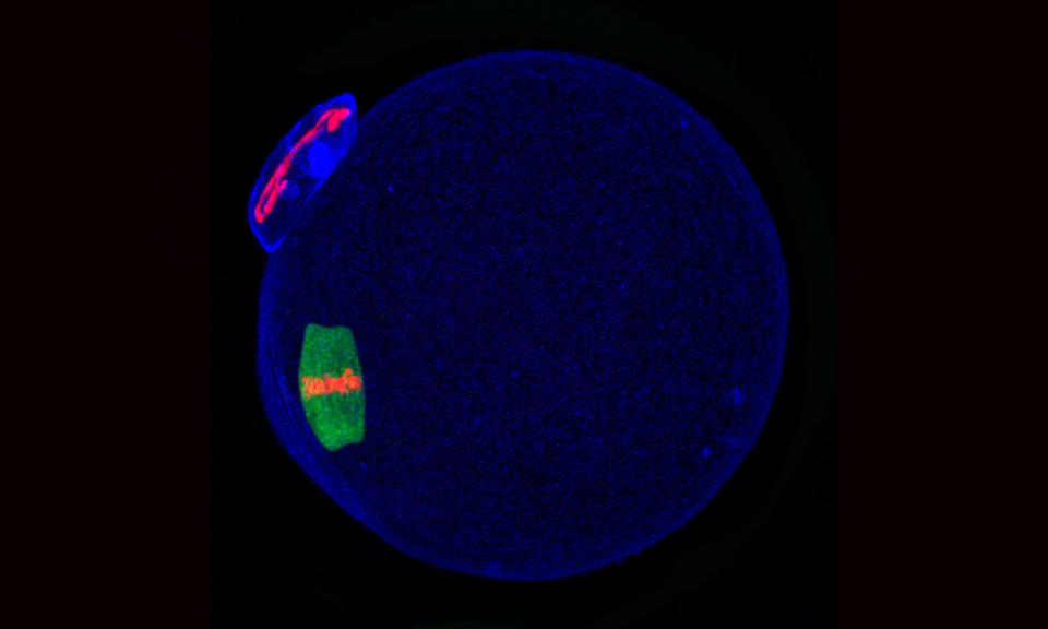 This picture shows the egg or “oocyte” preparing the genes that will be passed on to its offspring, which are highlighted in red.