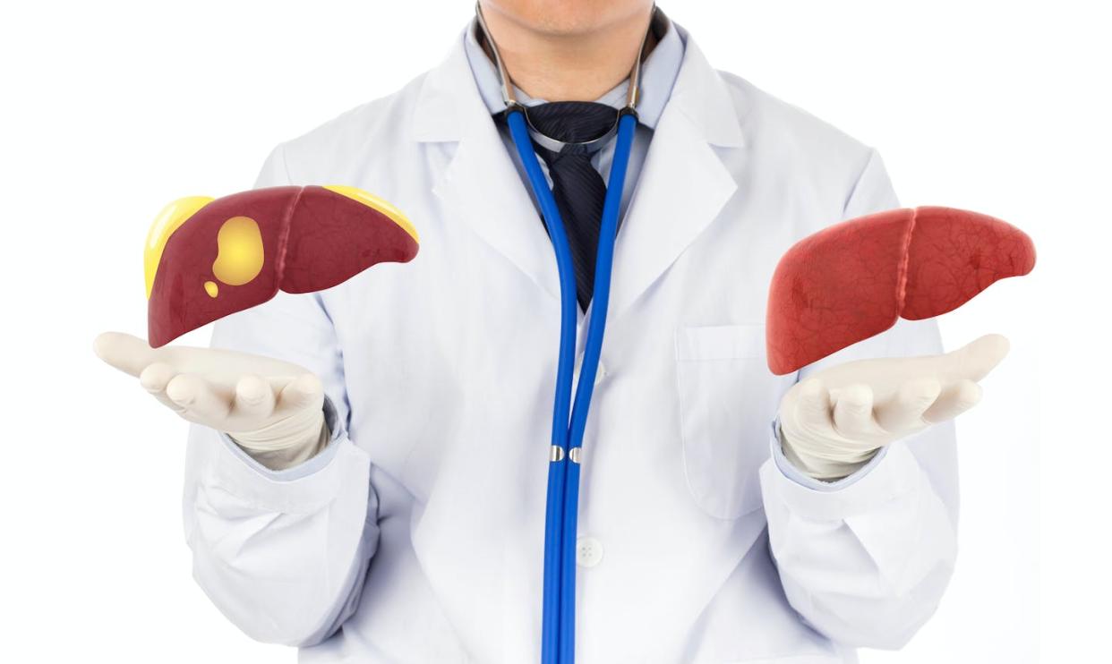 <a href="https://www.shutterstock.com/es/image-photo/doctor-touch-on-liver-concept-fatty-1539322550" rel="nofollow noopener" target="_blank" data-ylk="slk:SoftSheep / Shutterstock;elm:context_link;itc:0;sec:content-canvas" class="link ">SoftSheep / Shutterstock</a>