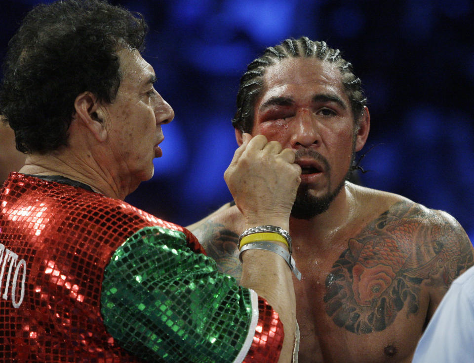 Antonio Margarito, of Mexico, reacts as his eye is worked on after the ninth round of an WBA World Junior Middleweight Championship boxing match against Miguel Cotto, of Puerto Rico, Sunday, Dec. 4, 2011 in New York. Cotto defeated Margarito with a TKO decision amid confusion in the corner before they came out for the 10th round. (AP Photo/Frank Franklin II)