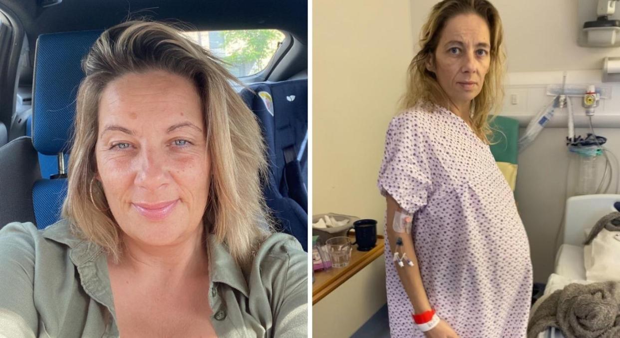 Sarah Haslam had to have a two-stone tumour removed from her womb. (Sarah Haslam/SWNS)