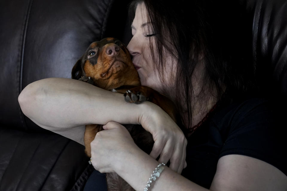 Double lung transplant recipient Kari Wegg kisses her dachshund, Maisie, in her home in Westfield, Ind., Monday, March 22, 2021. The Indiana nurse came down with COVID-19 in the summer of 2020; her condition spiraled downward, and her life was saved only by grace of a double lung transplant. The road to normal is a long one, but she's bolstered by the love and support of her husband and sons, and by her own indomitable spirit. (AP Photo/Charles Rex Arbogast)