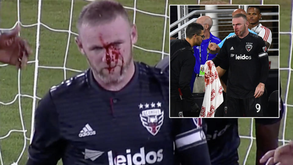 Wayne Rooney was left covered in blood at the Audi Field while playing for DC United.