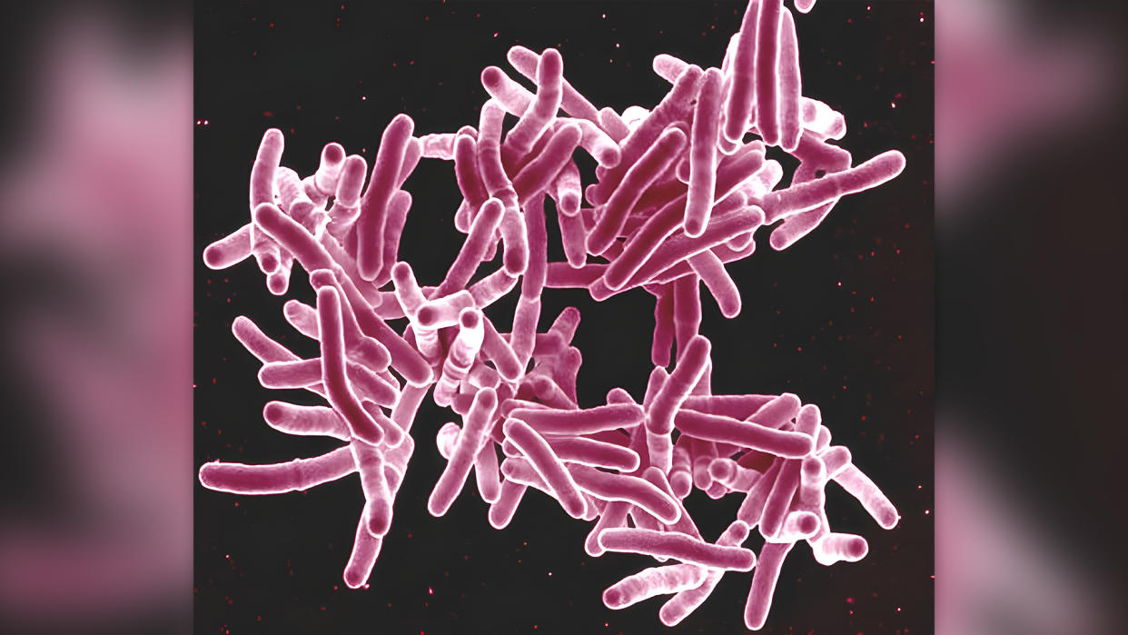  Scanning electron micrograph of Mycobacterium tuberculosis bacteria, which are rod-shaped and cause TB. 