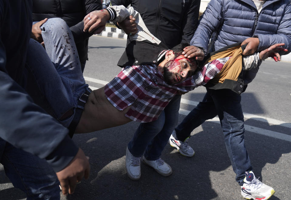 A injured protester is taken to hospital as protesters opposing a proposed U.S. half billion dollars grant for Nepal clash with police as the parliament debates the contentious aid in Kathmandu, Nepal, Sunday, Feb. 20, 2022. Opposition to the grant comes mainly from two Communist parties that are part of the coalition government who claim the conditions in the grant agreement will prevail over Nepal's laws and threaten the country's sovereignty. (AP Photo/Niranjan Shreshta)