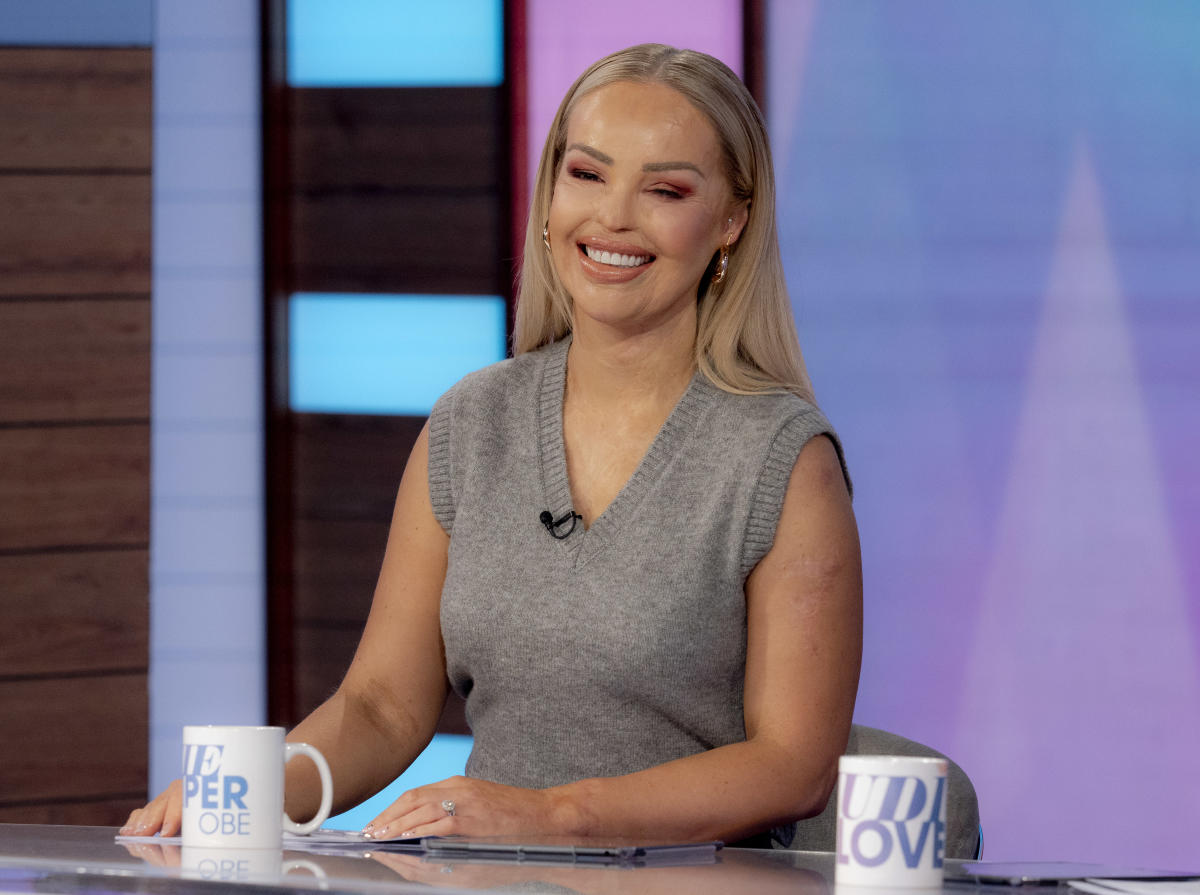 Katie Piper on why she s relieved her eye is sewn shut for a year