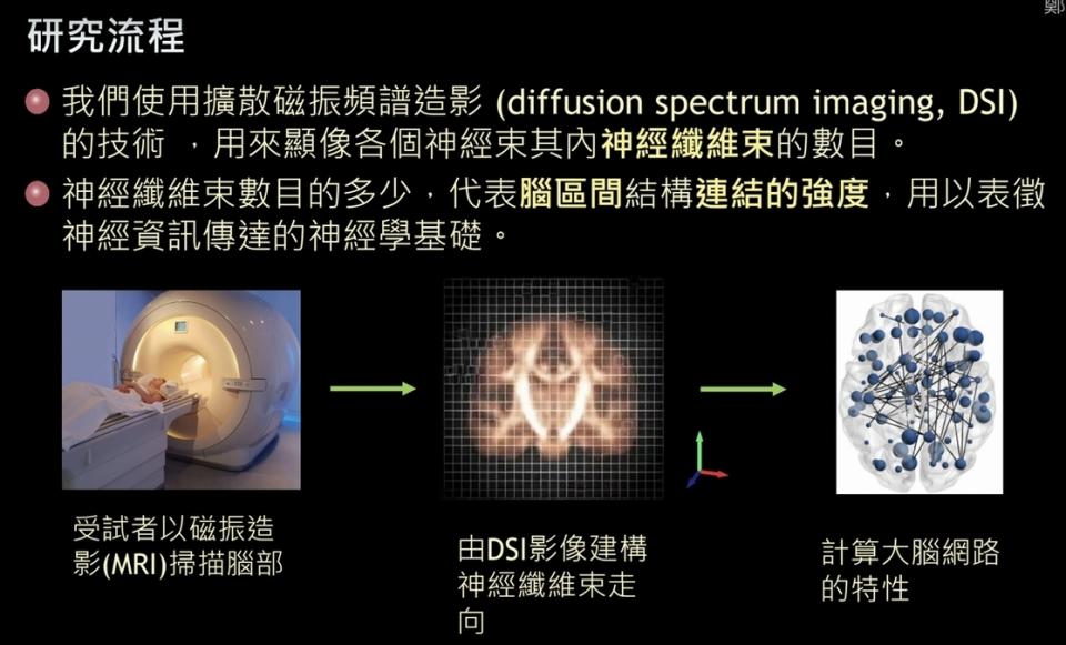 不同音樂型態　神經連結結構也不同