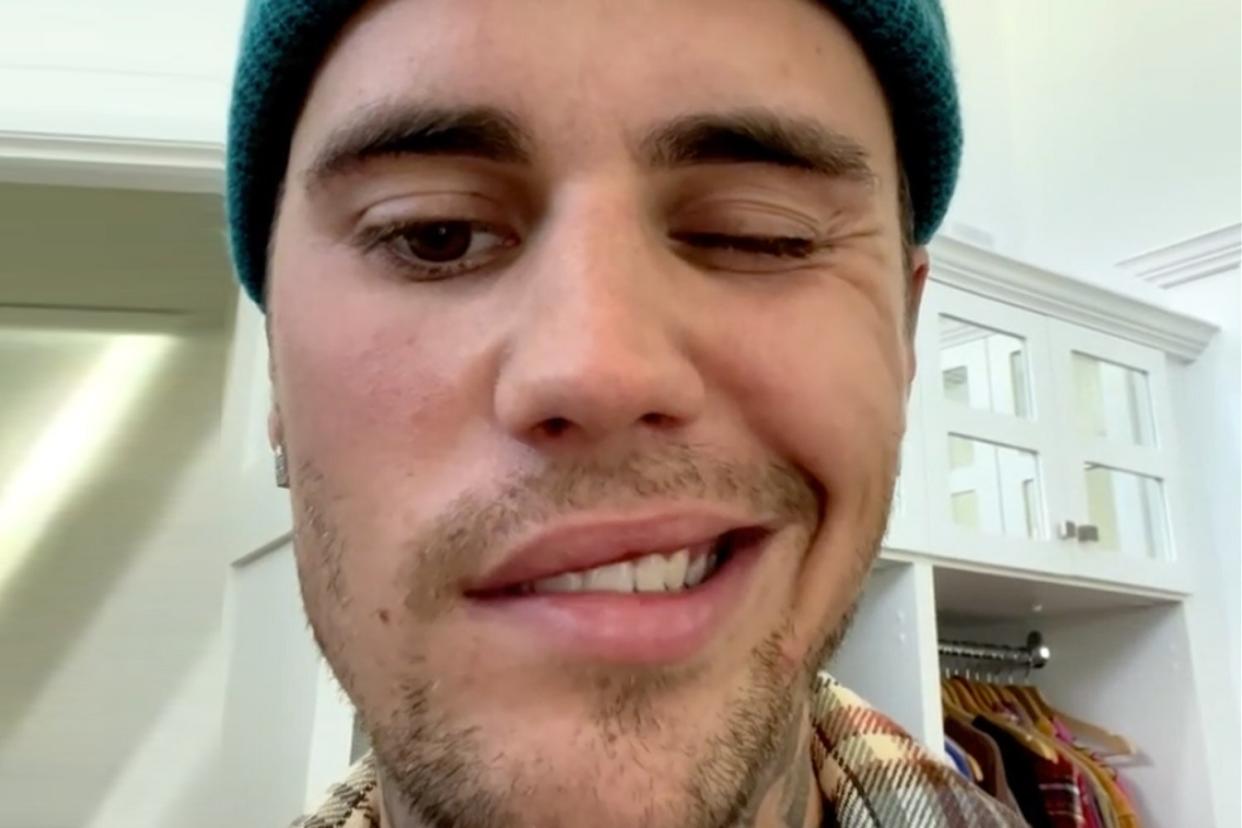 Justin Bieber Reveals He Has Ramsay Hunt Syndrome and His Face Is Partially Paralyzed: 'I Have Hope'