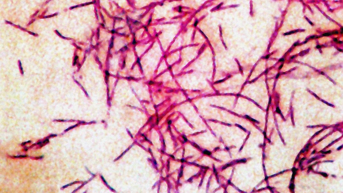 5 diagnosed with Legionnaires' disease in New Hampshire, health officials say