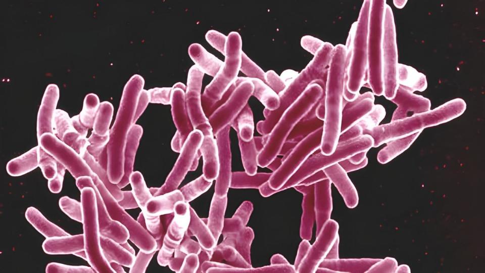 PHOTO: Scanning electron micrograph of Mycobacterium tuberculosis bacteria. (Bsip/BSIP/Universal Images Group via Getty Images)