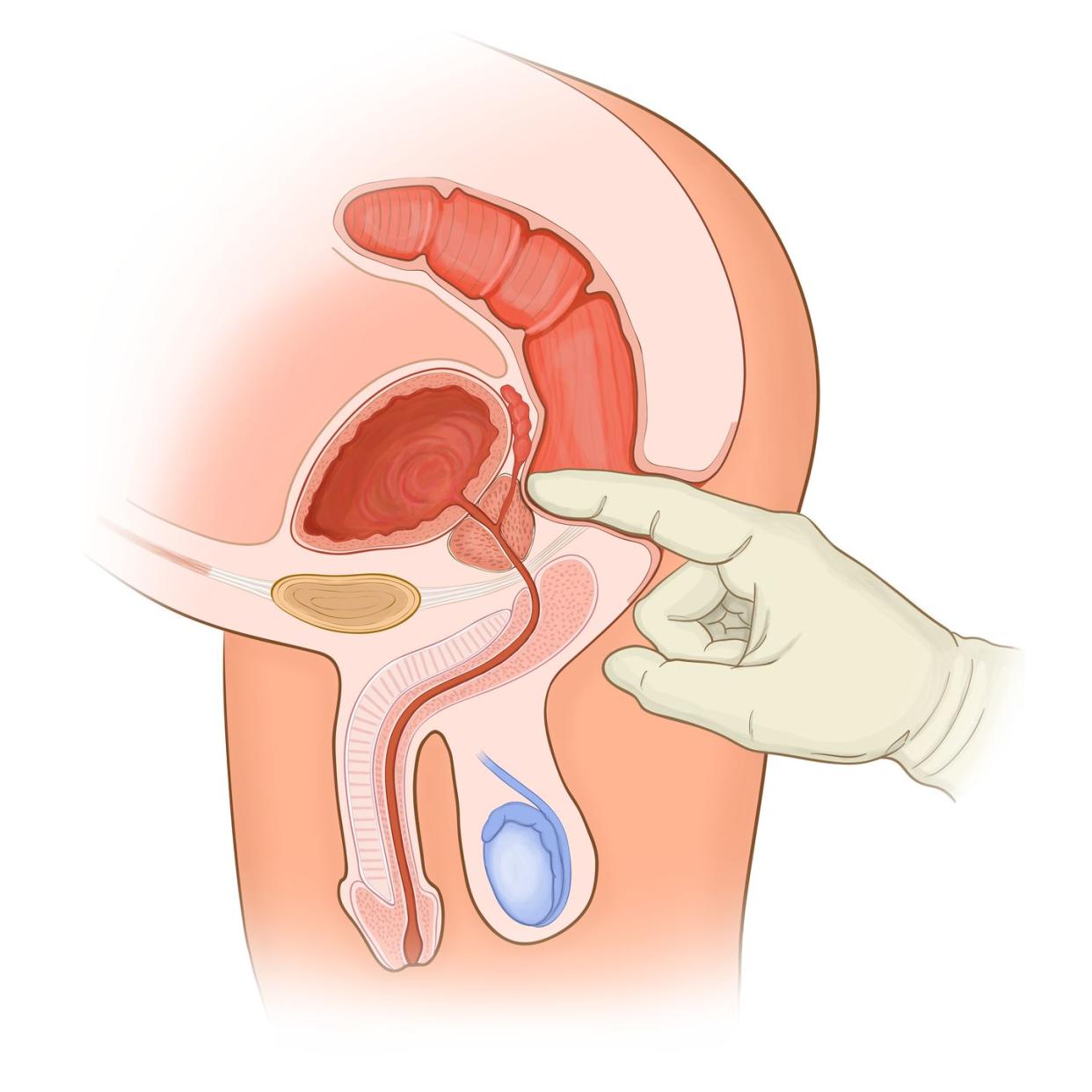 rectal exam of a normal male in cross section anatomy