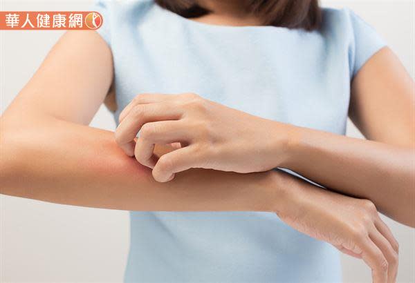 乾癬皮膚炎可以分為5大型：斑塊狀、滴狀、皮褶型、膿皰型與紅皮症。