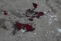 Shards of glass from a car and blood are seen on the pavement after multiple rocket system shelling by Armenian forces in Barda, Azerbaijan, Wednesday, Oct. 28, 2020. The Azerbaijani Defense Ministry rejected all the accusations and in turn accused Armenian forces of using the Smerch multiple rocket system to fire at the Azerbaijani towns of Terter and Barda. The strike on Barda killed more than 20 people and wounded 60, Azerbaijani officials said. (AP Photo/Aziz Karimov)