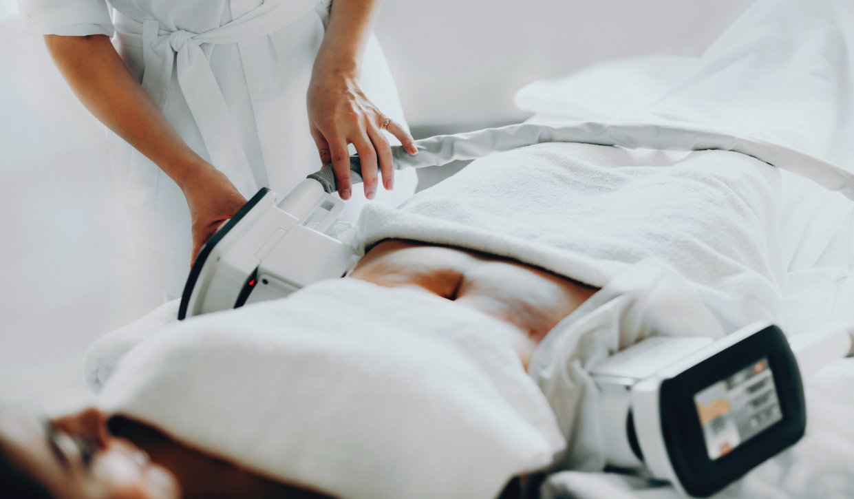 Woman Laying Down Having a Coolsculpting Treatment at a Dermatologist