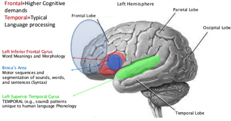 <span class="caption">Language areas of the brain.</span> <span class="attribution"><span class="source">wikipedia</span>, <a class="link " href="http://creativecommons.org/licenses/by-sa/4.0/" rel="nofollow noopener" target="_blank" data-ylk="slk:CC BY-SA;elm:context_link;itc:0;sec:content-canvas">CC BY-SA</a></span>