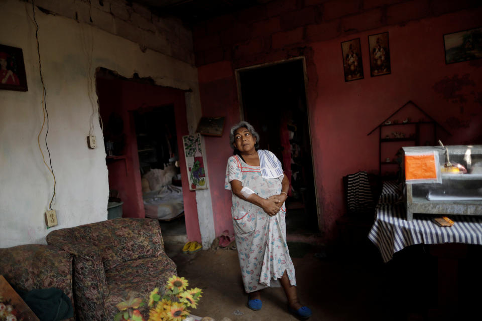 Lesbia Avila de Molina, 53, a kidney disease patient, holds her stomach due to pain, in her house during a blackout in Maracaibo, Venezuela. (Photo: Ueslei Marcelino/Reuters)