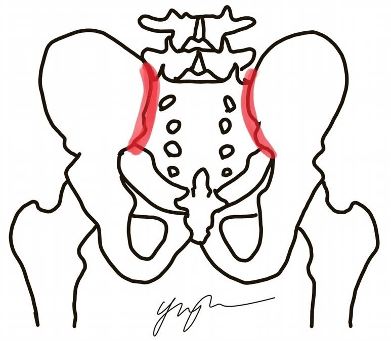 下背痛恐是「薦髂關節」失守 