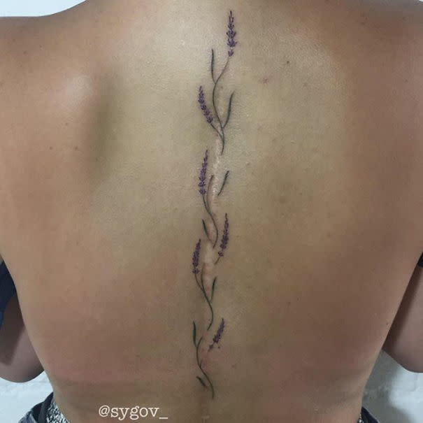 Tatuajes sobre cicatrices