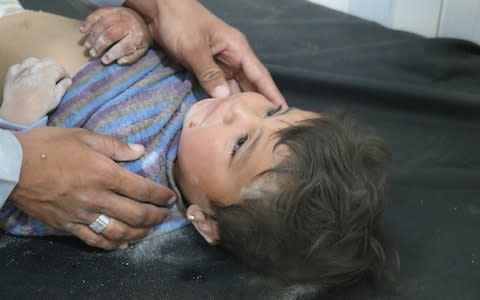 A wounded child receives medical treatment at a hospital after air attacks - Credit: Anadolu