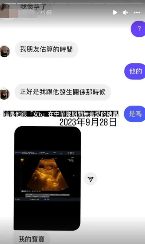 小三懷孕。翻攝自女子IG