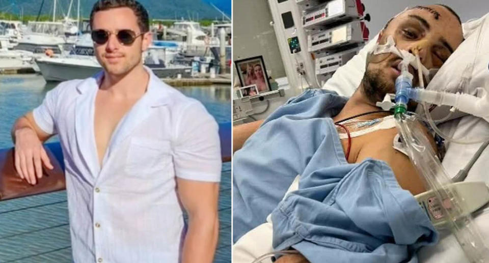 Adelaide man Blake Gibb in Bali hospital after bike accident. 