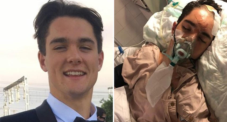 Image of NSW teen Lawson Rankin before Bali scooter crash, and injured in hospital afterwards.