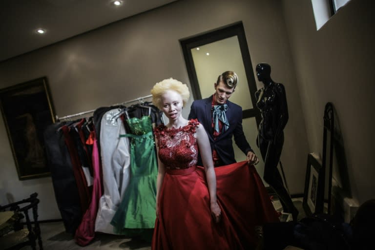 Thando Hopa grew up in the shade, her porcelain skin protected by long sleeves and sunscreen until the day the South African decided to fight prejudice against albinos by becoming a model