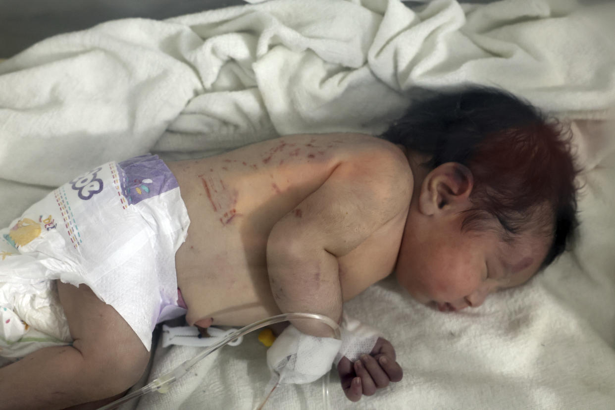 A baby girl who was born under the rubble caused by an earthquake that hit Syria and Turkey receives treatment inside an incubator at a children's hospital in the town of Afrin, Aleppo province, Syria, Tuesday, Feb. 7, 2023. Residents in the northwest Syrian town discovered the crying infant whose mother gave birth to her while buried underneath the rubble of a five-story apartment building levelled by this week’s devastating earthquake, relatives and a doctor say. (AP Photo/Ghaith Alsayed)