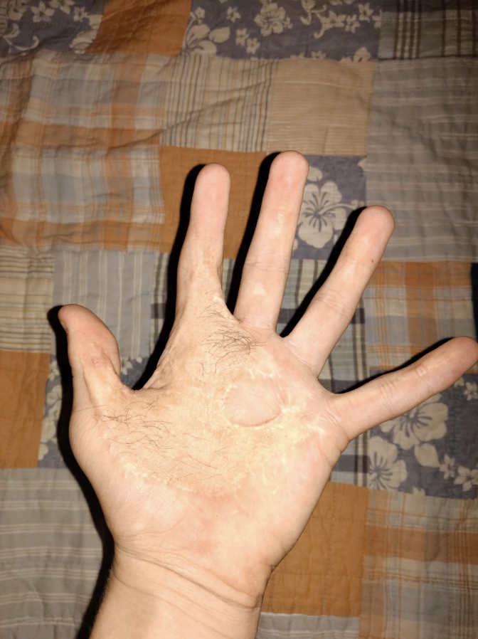 A person's palm facing the camera with fingers spread apart