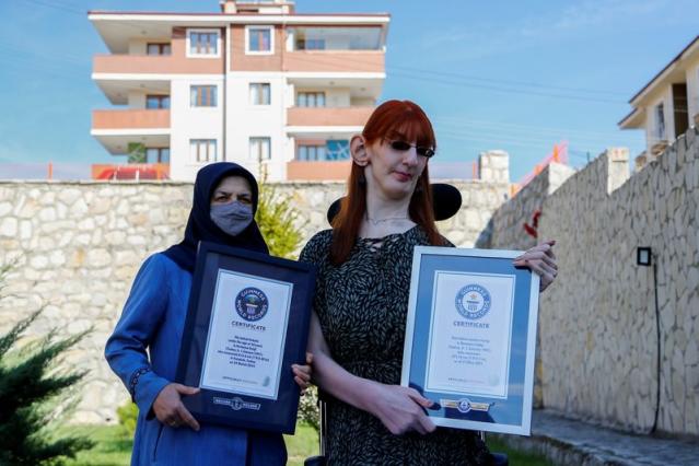 Rumeysa Gelgi is the tallest woman in the world, not the woman