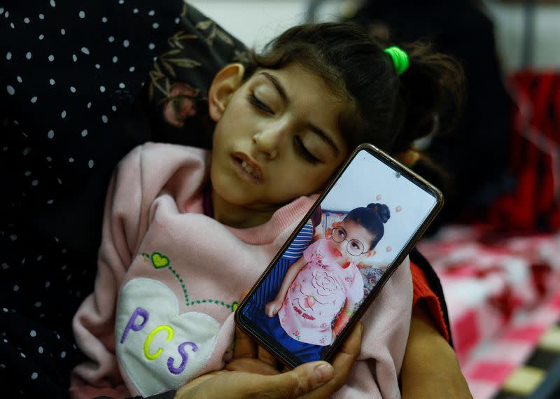 Palestinian woman Umm Mesbah Heji holds her malnourished daughter Israa, in Rafah in the southern Gaza Strip