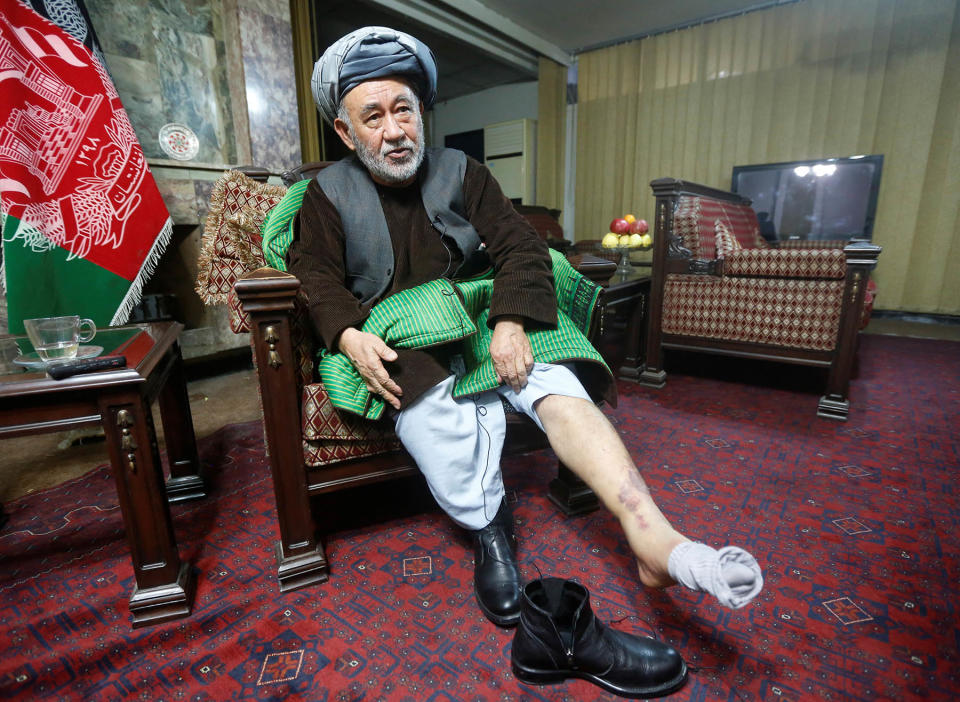 Ahmad Ishchi, who is reported to have been beaten and detained by Afghanistan’s vice president Abdul Rashid Dostum last month, displays an injury on his leg during an interview at his home in Kabul, Afghanistan December 13, 2016. Dostum denied abducting Ishchi, saying he was in police custody. Dostum's office did not immediately respond to a request for comment.  REUTERS/Omar Sobhani - RC1C974B3290