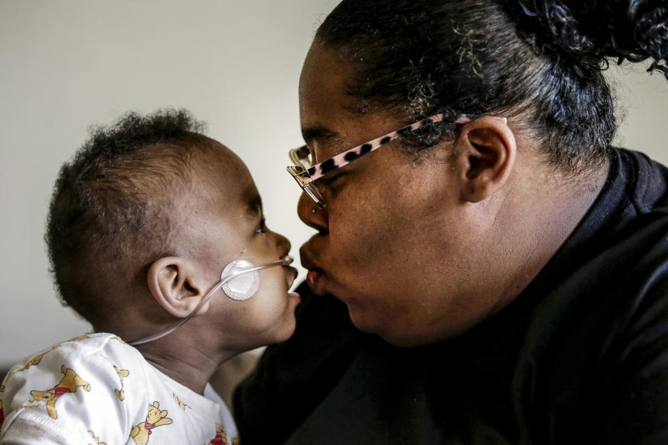 Curtis Means kisses his mother, Michelle Butler at their home in Eutaw, Ala., on Wednesday, March 23, 2022. Butler was just over halfway through her pregnancy when her water broke and contractions wracked her body. She couldn’t escape a terrifying truth: Her twins were coming much too soon. (AP Photo/Butch Dill)