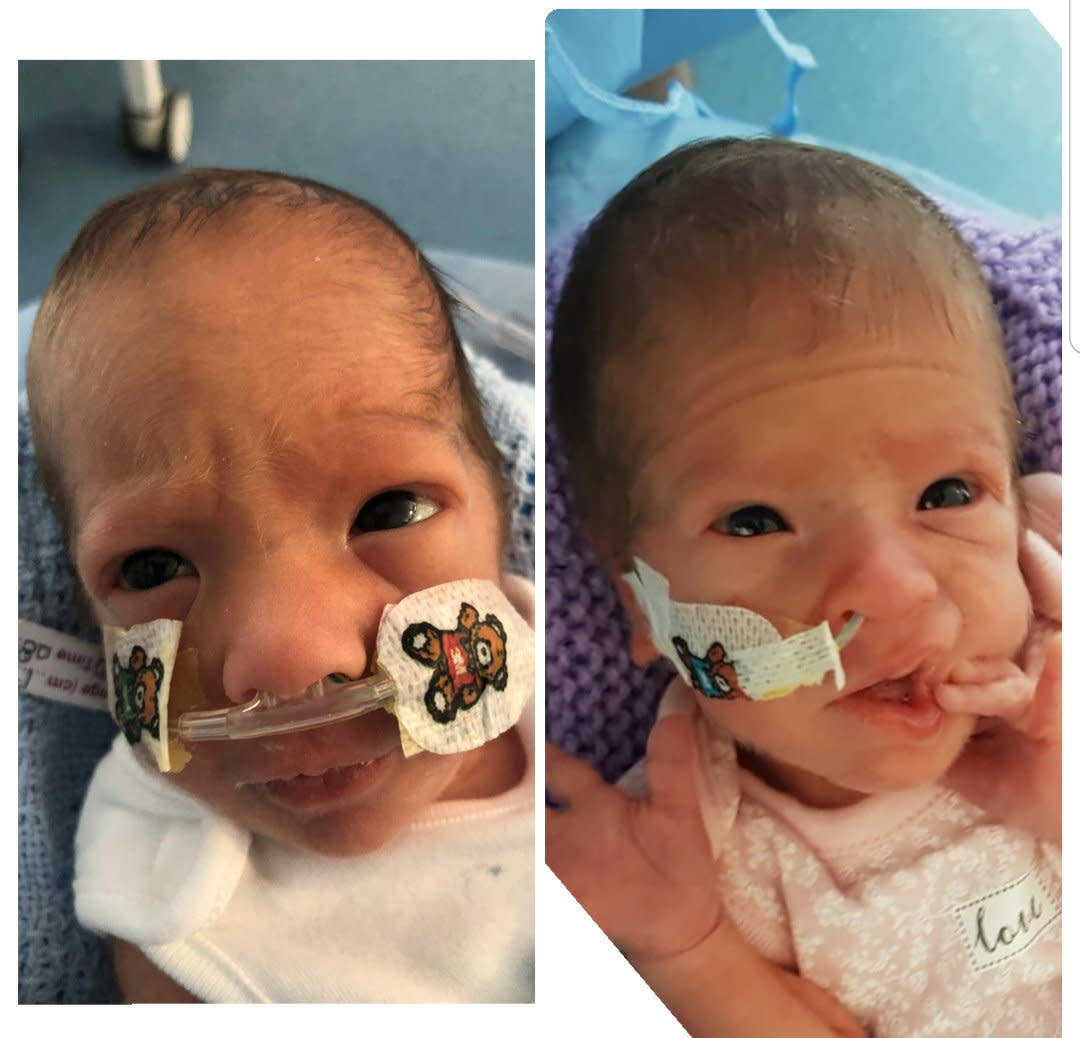 Zaki and Malika Ridge - who turn one on Saturday - arrived on 17 July 2020 at Luton and Dunstable University Hospital, Bedfordshire, weighing 2lbs 10oz and 2lbs 5oz respectively