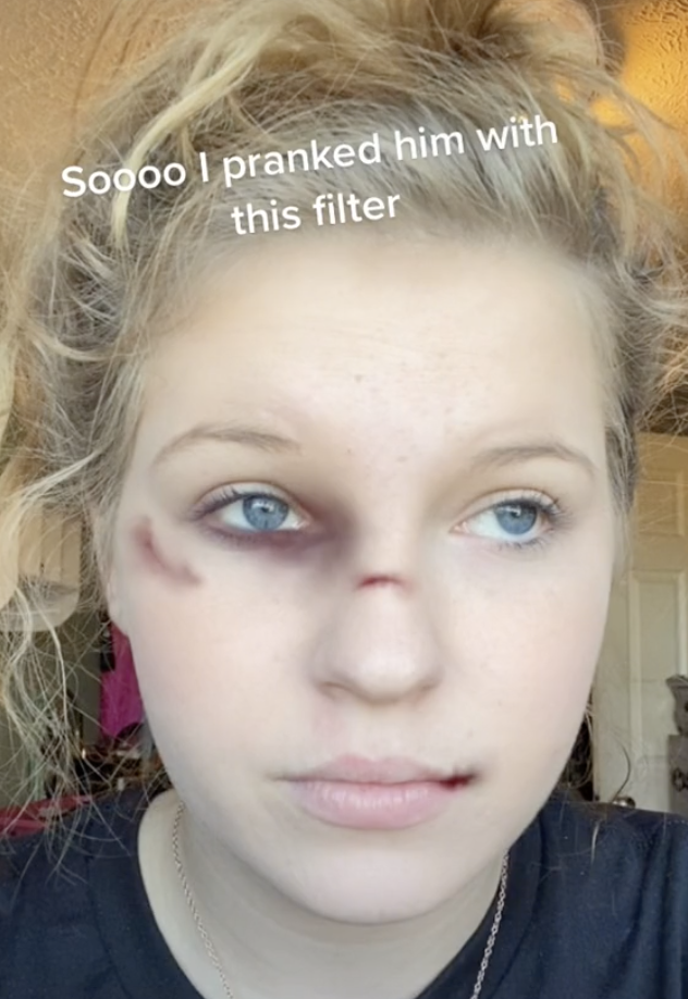 Some users are trying to trick friends and family by sending them photos of themselves with bruises on their face. Source: TikTok