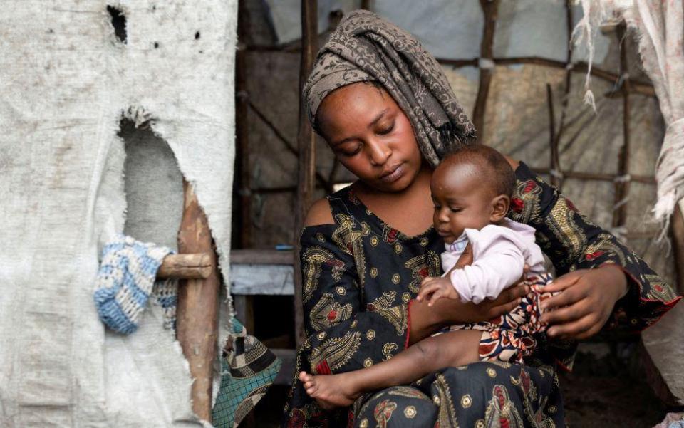 Justine Munguiko holds her child who has been cured of Mpox.