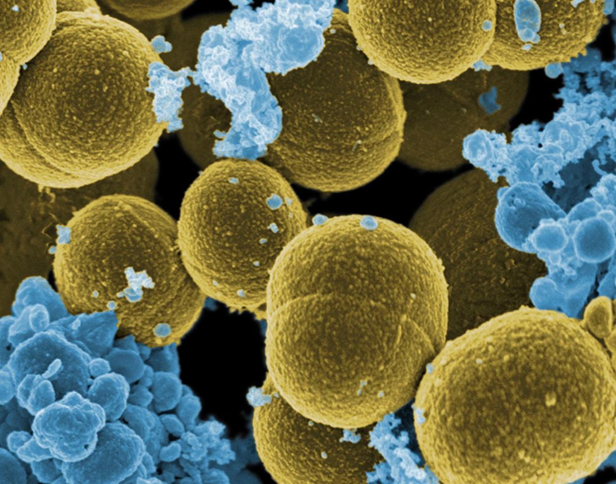 Staphylococcus aureus, una de las bacterias que muestra una alta resistencia a nuestros actuales fármacos | Wikicommons