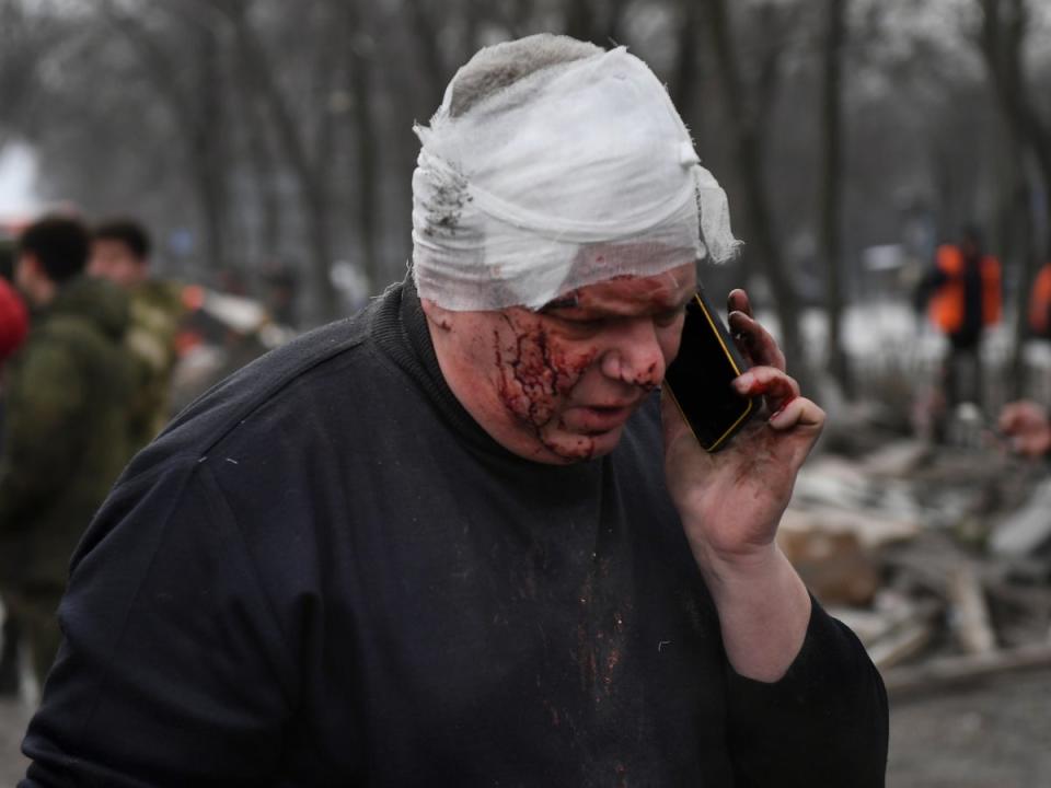 A wounded man on the phone in Donetsk after a shopping centre was destroyed (AP)